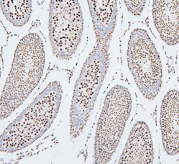 a02295 1 ube2i primary antibodies ihc testing 8