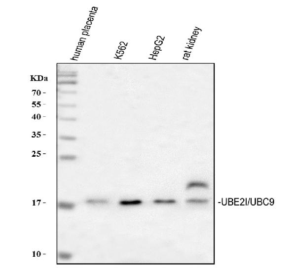 Figure 1. Western blot analysis of UBC9/UBE2I using anti-UBC9/UBE2I antibody (A02295-1). Electrophoresis was performed on a 5-20% SDS-PAGE gel at 70V (Stacking gel) / 90V (Resolving gel) for 2-3 hours. The sample well of each lane was loaded with 30 ug of sample under reducing conditions. Lane 1: human placenta tissue lysates, Lane 2: human K562 whole cell lysates, Lane 3: human HepG2 whole cell lysates, Lane 4: rat kidney tissue lysates. After electrophoresis, proteins were transferred to a nitrocellulose membrane at 150 mA for 50-90 minutes. Blocked the membrane with 5% non-fat milk/TBS for 1.5 hour at RT. The membrane was incubated with rabbit anti-UBC9/UBE2I antigen affinity purified polyclonal antibody (A02295-1) at 0.5 microg/mL overnight at 4°C, then washed with TBS-0.1%Tween 3 times with 5 minutes each and probed with a goat anti-rabbit IgG-HRP secondary antibody at a dilution of 1:5000 for 1.5 hour at RT. The signal is developed using an Enhanced Chemiluminescent detection (ECL) kit (Catalog # EK1002) with Tanon 5200 system. A specific band was detected for UBC9/UBE2I at approximately 18 kDa. The expected band size for UBC9/UBE2I is at 18 kDa.