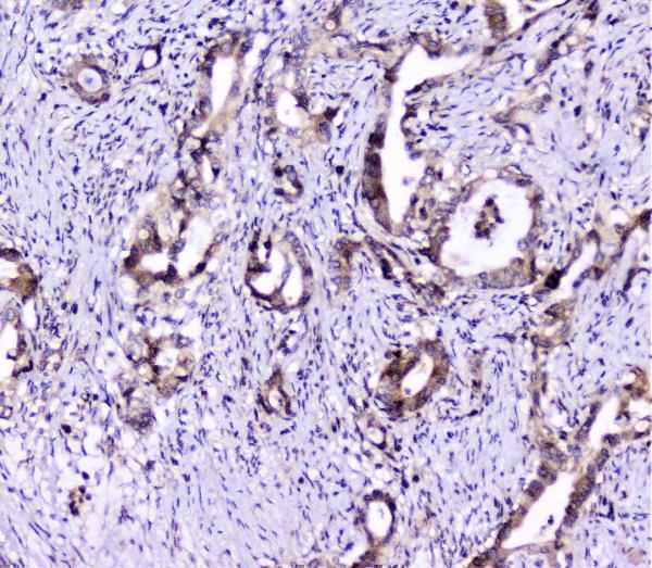 UBE2I UBC9 Antibody A02295