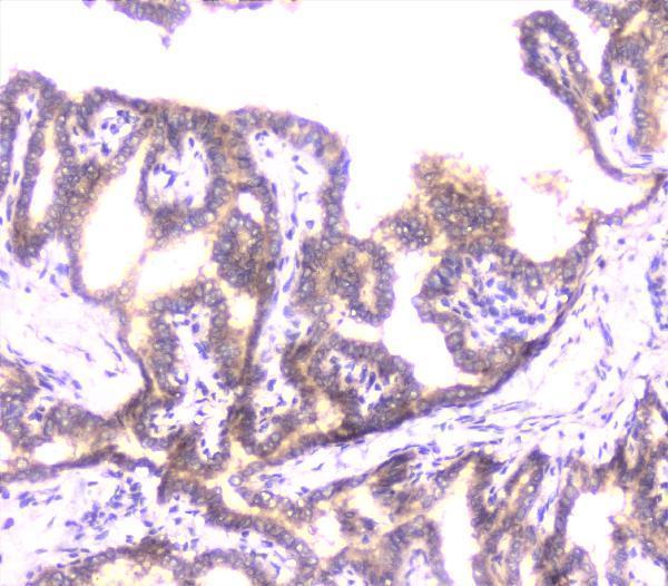 a02295 ube2i ubc9 primary antibodies ihc testing 11