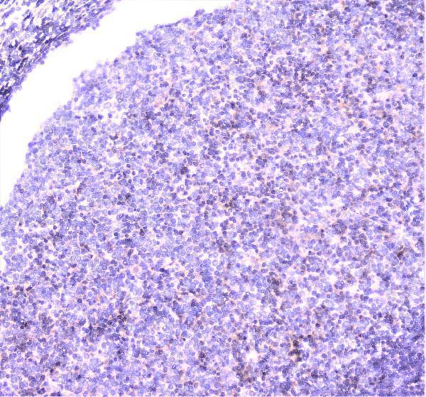 a02295 ube2i ubc9 primary antibodies ihc testing 12