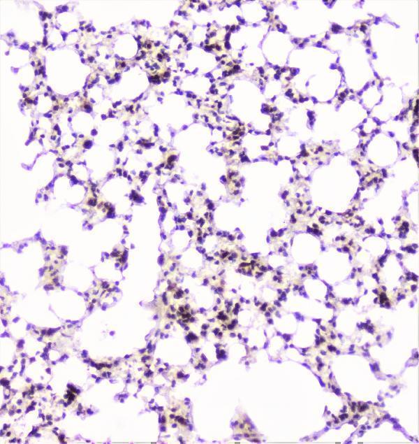 a02295 ube2i ubc9 primary antibodies ihc testing 14