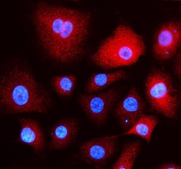 a02296 3 eea1 primary antibodies if testing 5