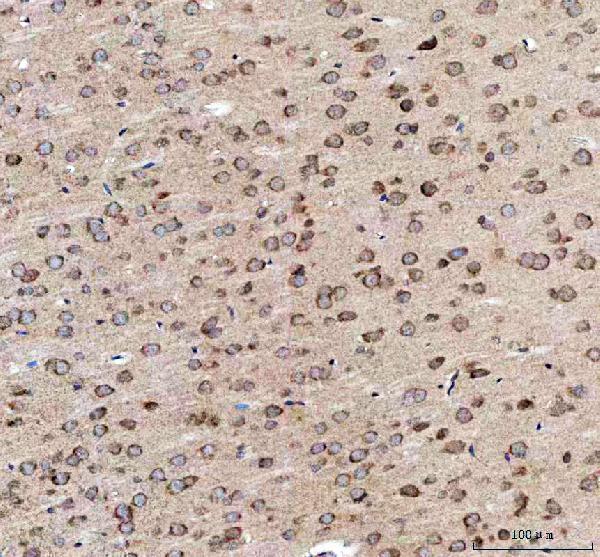 a02296 3 eea1 primary antibodies ihc testing 4