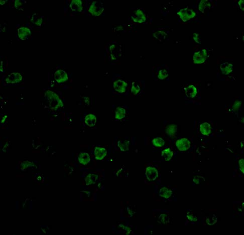 Immunofluorescence of TNFRSF14 in Raji cells with TNFRSF14 antibody at 20 μg/mL