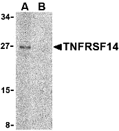 Western blot analysis of TNFRSF14 in Raji cell lysate with TNFRSF14 antibody at 2 μg/mL in (A) the absence and (B) the presence of blocking peptide