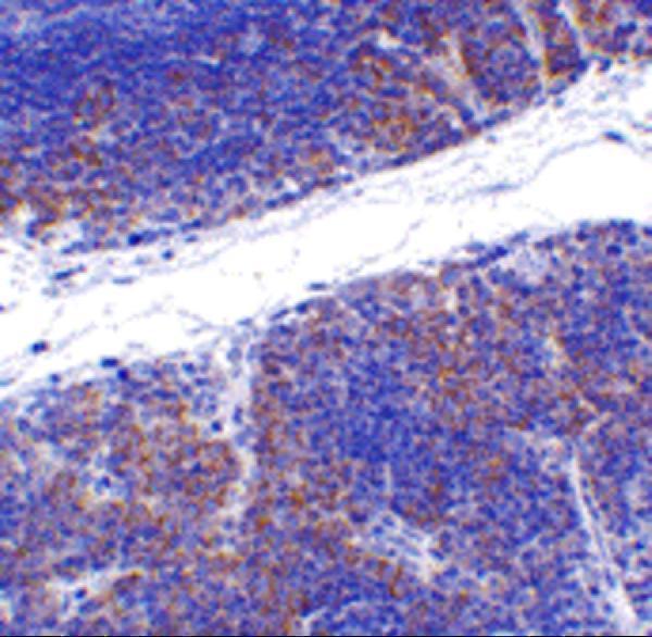 Immunohistochemistry of TNFRSF14 in mouse thymus tissue with TNFRSF14 antibody at 1 μg/mL