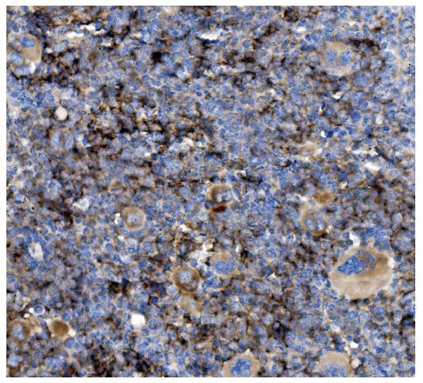  IHC analysis of CD82 using anti-CD82 antibody (A02300-1)