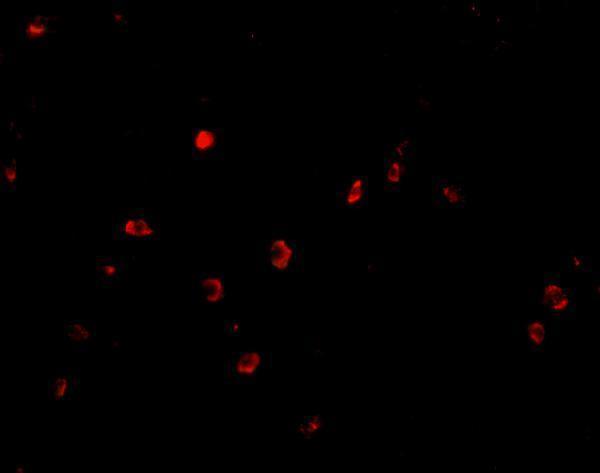 Immunofluorescence of KAI1 in Human Colon cells with KAI1 antibody at 20 μg/mL