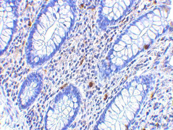 Immunohistochemistry of KAI1 in human colon tissue with KAI1 antibody at 2