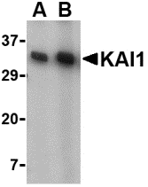Western blot analysis of KAI1 in A549 cell lysate with KAI1 antibody at (A) 0