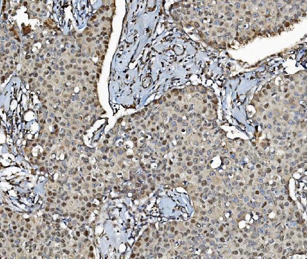 a02301 1 mcm4 primary antibodies ihc testing 4