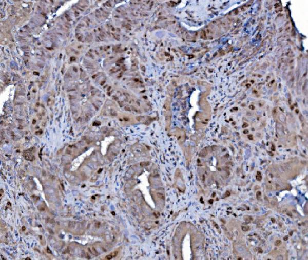 a02301 1 mcm4 primary antibodies ihc testing 5