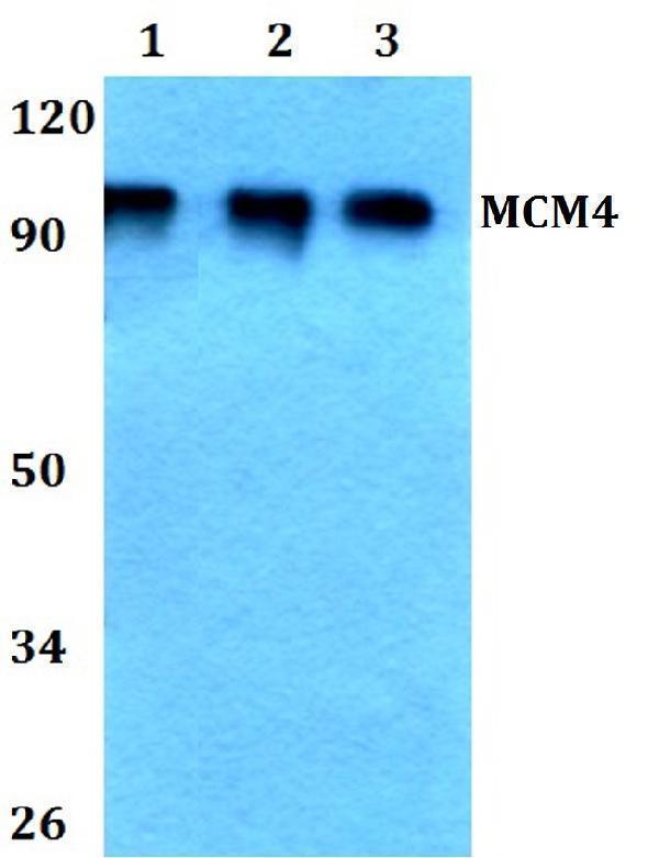 Western blot (WB) analysis of MCM4 (P50) polyclonal antibody at 1:500 dilution
Lane1:HEK293T whole cell lysate
Lane2:Raw264