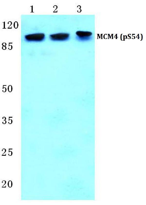 Western blot (WB) analysis of p-MCM4 (S54) polyclonal antibody at 1:500 dilution
Lane1:LO2 cell lysate treated with EGF(0