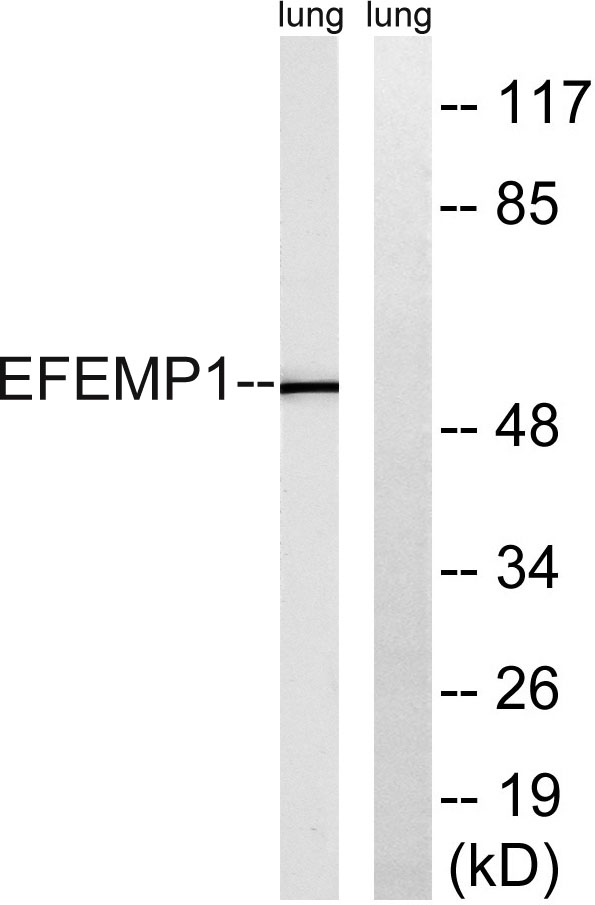 Western blot analysis of lysates from rat lung, using EFEMP1 Antibody