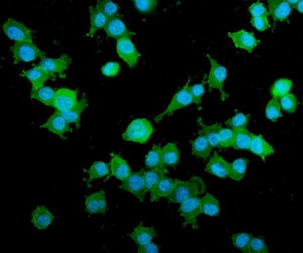 a02303 3 akap12 primary antibodies if testing 5