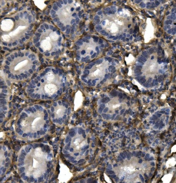  IHC analysis of AKAP12 using anti-AKAP12 antibody (A02303-3)