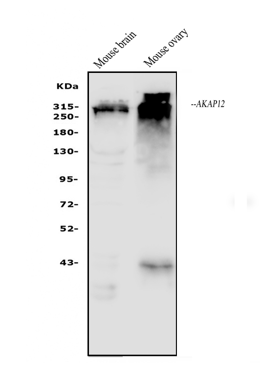  Western blot analysis of AKAP12 using anti-AKAP12 antibody (A02303-3)