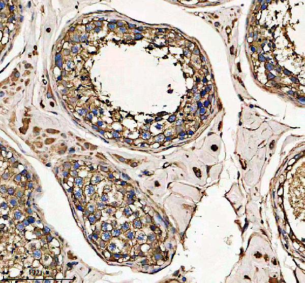 IHC analysis of AKAP12 using anti-AKAP12 antibody (A02303-4)