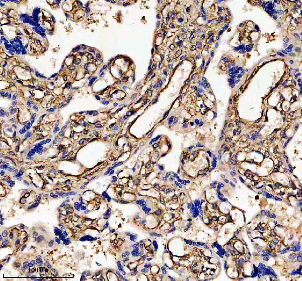 IHC analysis of AKAP12 using anti-AKAP12 antibody (A02303-4)
