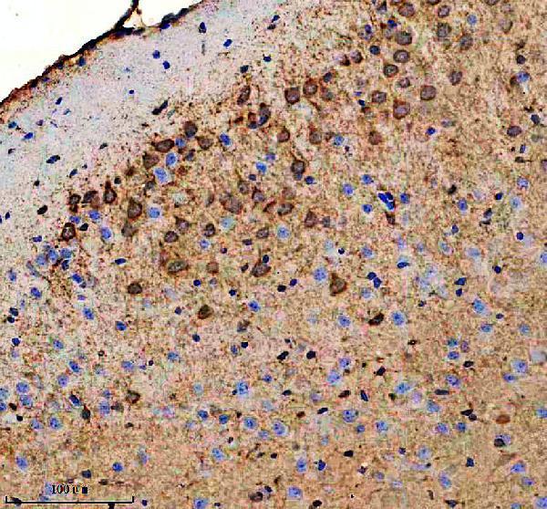 a02303 4 akap12 primary antibodies ihc testing 3