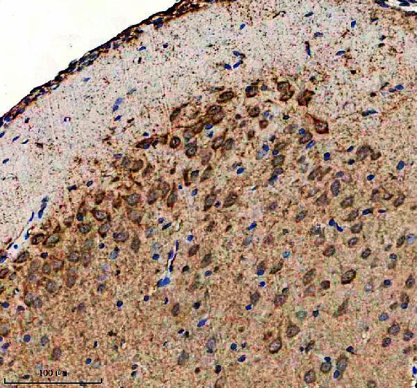 a02303 4 akap12 primary antibodies ihc testing 4