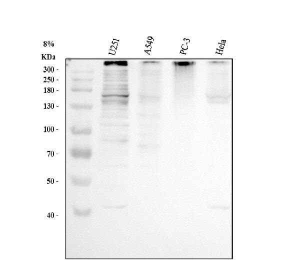 Western blot analysis of AKAP12 using anti-AKAP12 antibody (A02303-4)