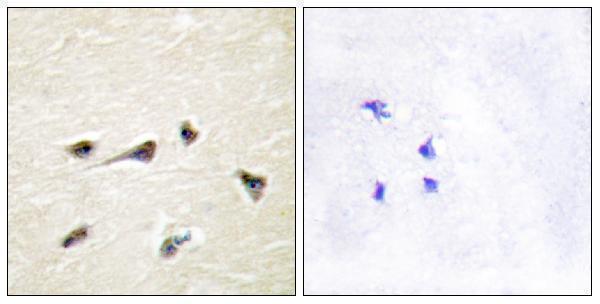 Immunohistochemistry analysis of paraffin-embedded human brain tissue, using AKAP12 Antibody