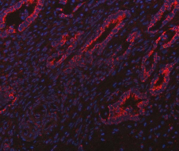 a02304 itpa primary antibodies if testing 10