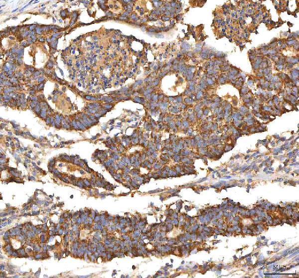 a02304 itpa primary antibodies ihc testing 2