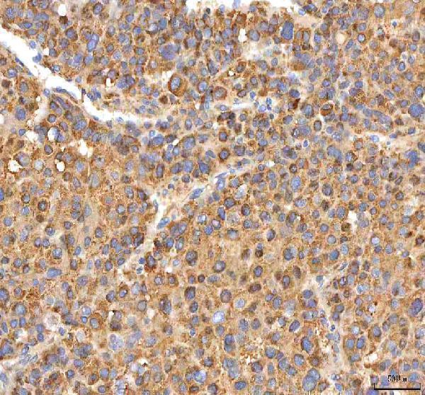 a02304 itpa primary antibodies ihc testing 4