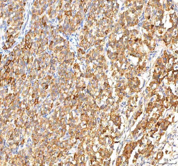 a02304 itpa primary antibodies ihc testing 5
