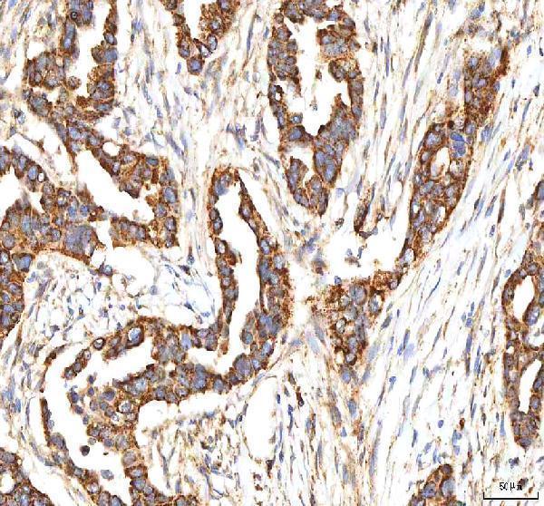 a02304 itpa primary antibodies ihc testing 6