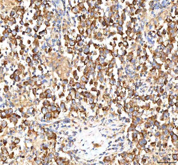 a02304 itpa primary antibodies ihc testing 7