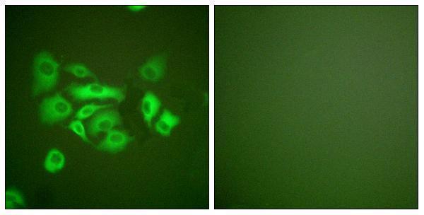 a02305 1 krt10 primary antibodies if testing 1