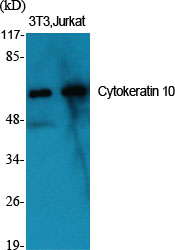a02305 1 krt10 primary antibodies wb testing 2