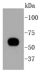 a02305 2 krt10 primary antiboties wb testing 1