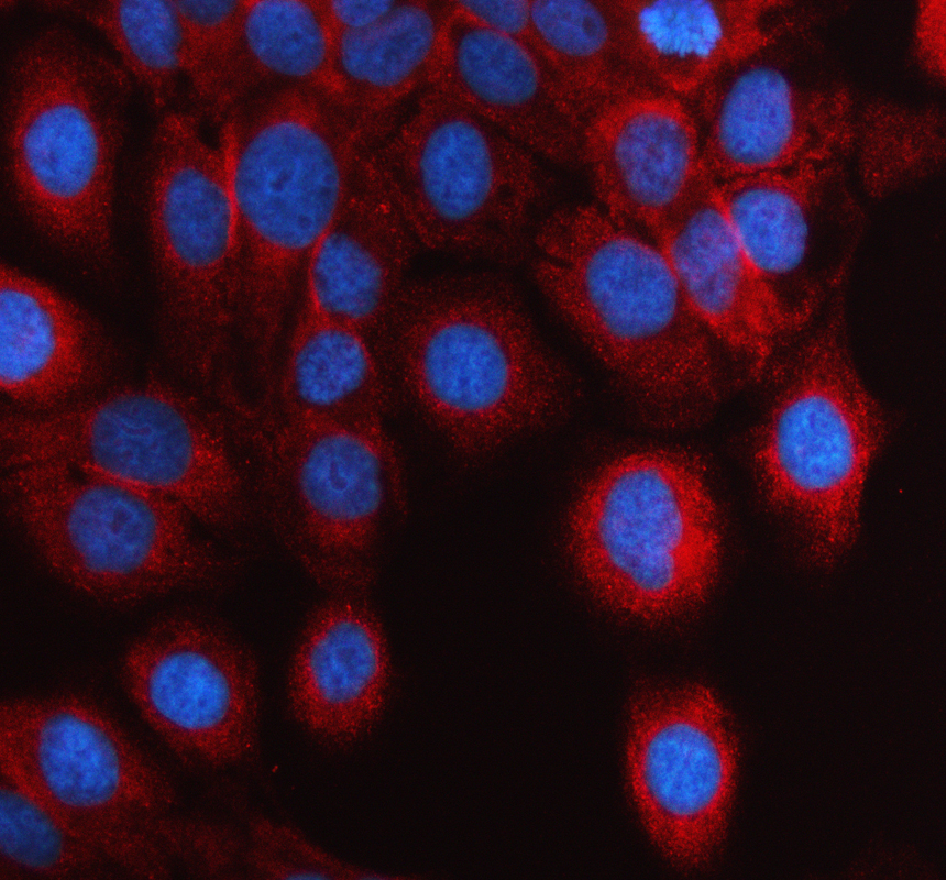 a02305 3 krt10 primary antibodies if testing 1