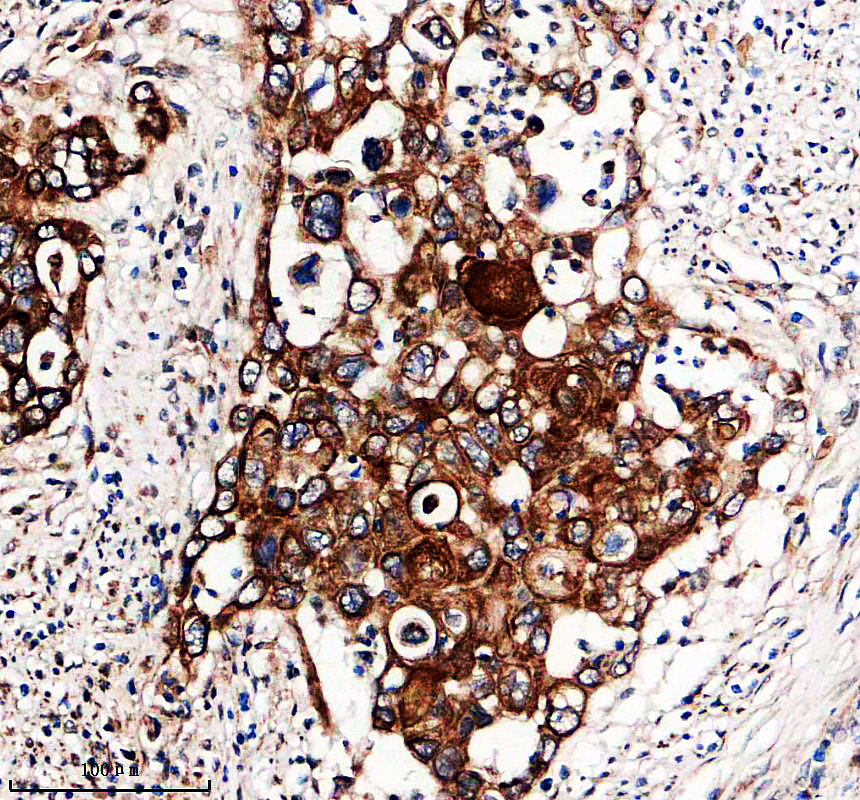 IHC analysis of KRT10 using anti-KRT10 antibody (A02305-3)