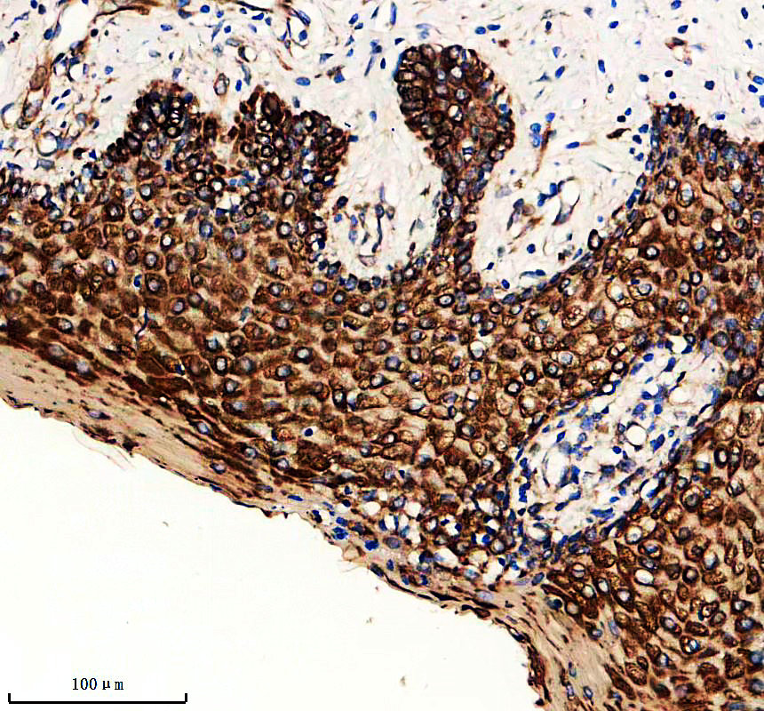 IHC analysis of KRT10 using anti-KRT10 antibody (A02305-3)