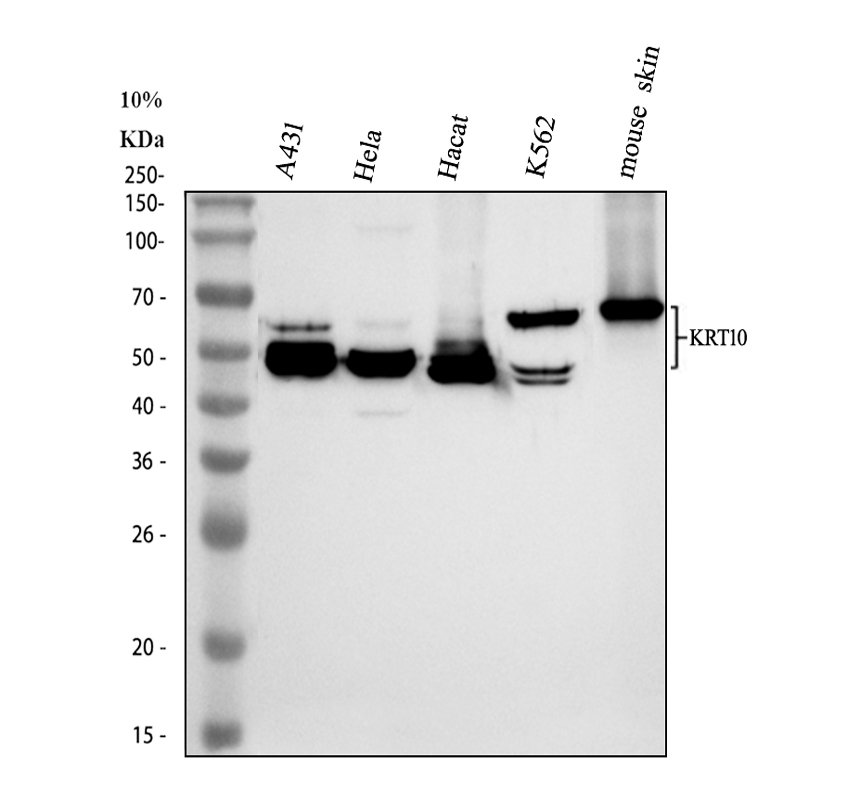 Western blot analysis of KRT10 using anti-KRT10 antibody (A02305-3)