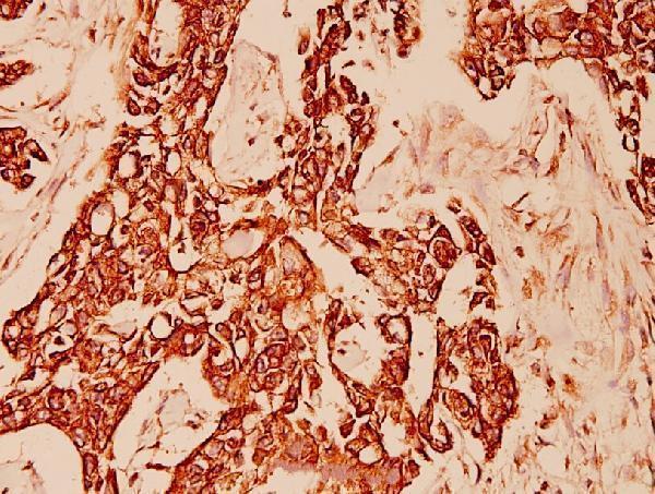 a02305y160 krt10 primary antiboties ihc testing 2