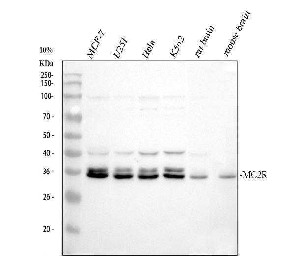 Western blot analysis of MC2R using anti-MC2R antibody (A02306-1)