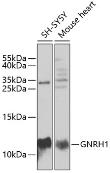 Western blot analysis of extracts of Mouse lung, using GNRH1 antibody  at 1:1000 dilution