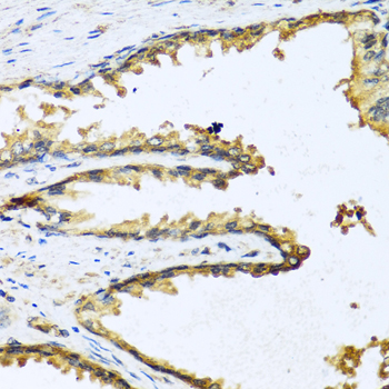 Western blot analysis of extracts of Rat kidney, using GNRH1 antibody  at 1:1000 dilution