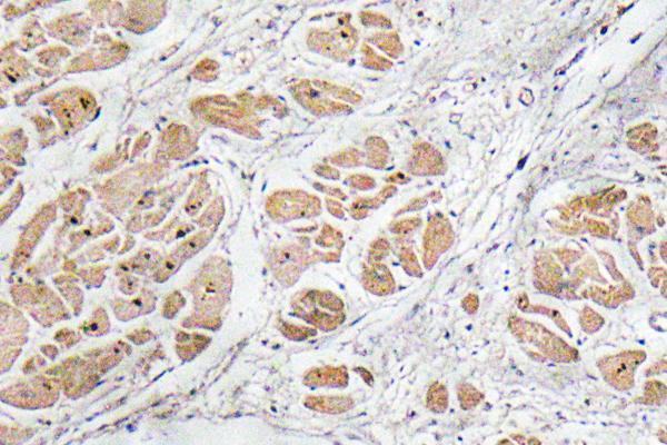Immunohistochemistry analysis of GnRH I antibody in paraffin-embedded human heart tissue