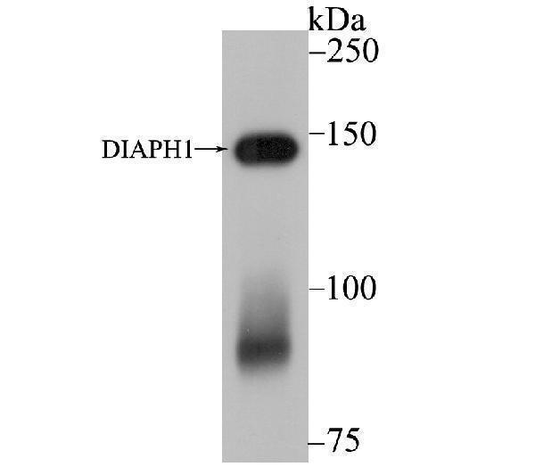Western blot analysis of DIAPH1 on SiHa cell lysate using anti-DIAPH1 antibody at 1/5,000 dilution