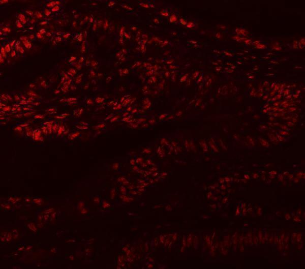 a02309 1 mbnl1 primary antibodies if testing 10
