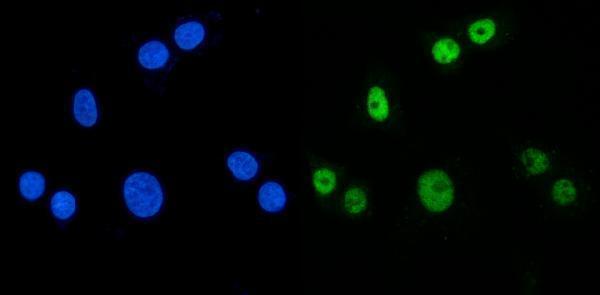 a02309 1 mbnl1 primary antibodies if testing 9